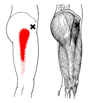 大腿筋膜腸筋